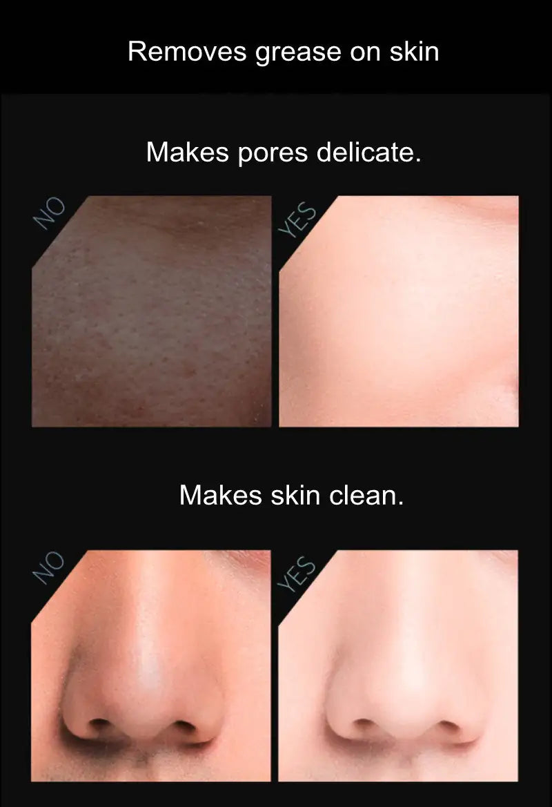 Volcanic Oil-Absorbing Face Roller – Instant Shine Control